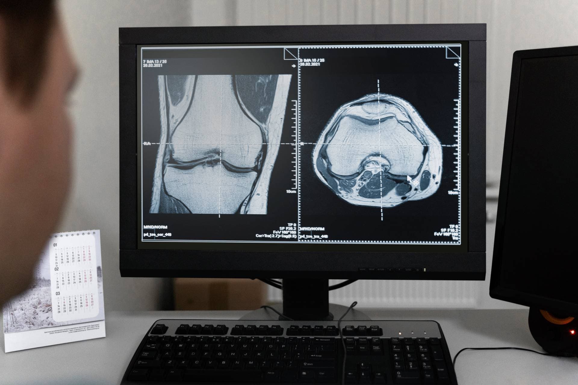 A knee MRI scan on a monitor, reviewed directly before the consultation